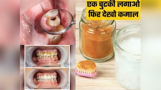 पीले दांत, मुंह की बदबू और दांतों के कीड़ों को बाहर निकाल देहा ये देसी मंजन, किचन की चीजों से बनाएं फिर देखें कमाल