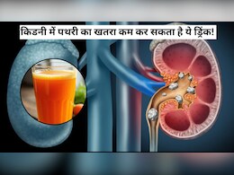 किडनी में पथरी का खतरा कम कर सकता है ये ड्रिंक, इन लोगों को जरूर करना चाहिए इसका सेवन