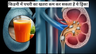 किडनी में पथरी का खतरा कम कर सकता है ये ड्रिंक, इन लोगों को जरूर करना चाहिए इसका सेवन