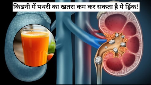 किडनी में पथरी का खतरा कम कर सकता है ये ड्रिंक, इन लोगों को जरूर करना चाहिए इसका सेवन