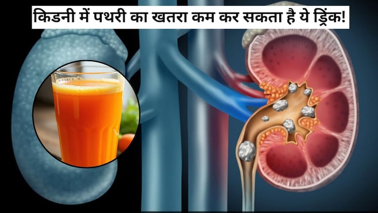 किडनी में पथरी का खतरा कम कर सकता है ये ड्रिंक, इन लोगों को जरूर करना चाहिए इसका सेवन