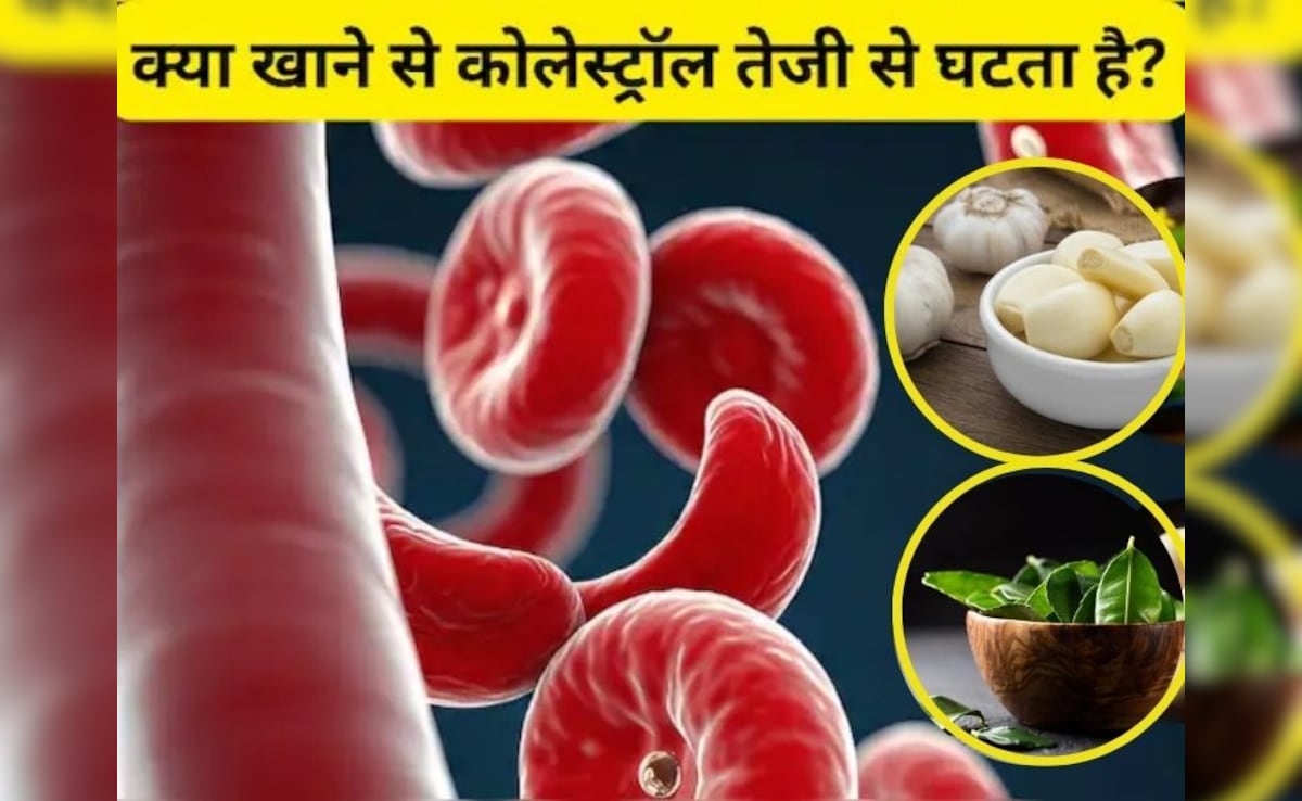 बिना दवा लिए कंट्रोल होगा कोलेस्ट्रॉल, बस फॉलो करें ये टिप्स और डाइट प्लान