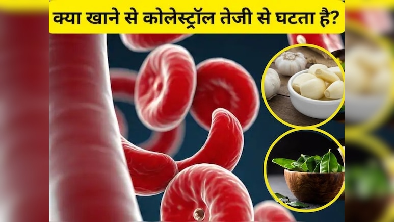 बिना दवाओं के कोलेस्ट्रॉल को कंट्रोल करेंगी ये 5 चीजें, फिर कभी नहीं खानी पडेंगी Cholesterol कंट्रोल करने वाली Medicine