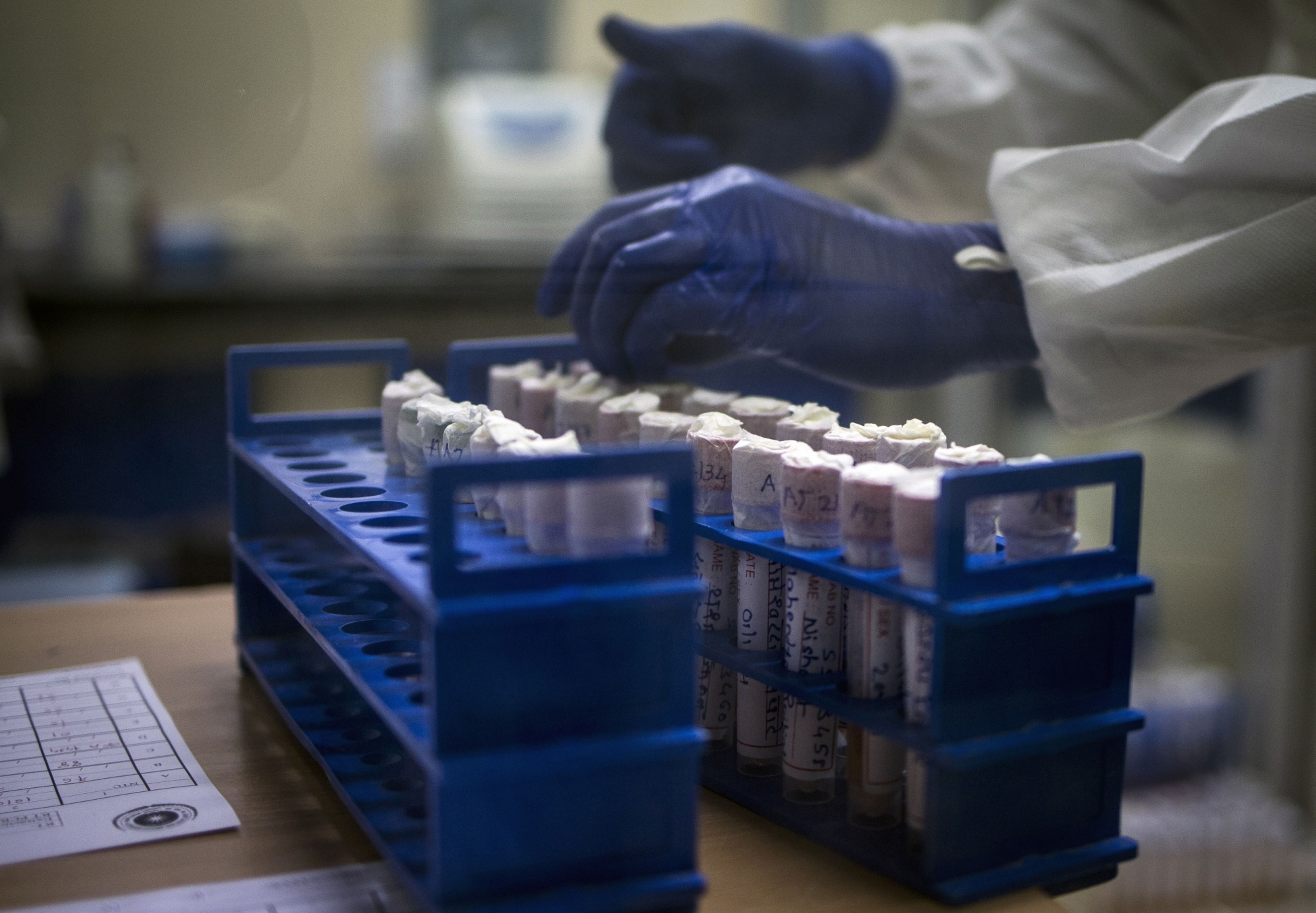 Covid-19 India Updates: 1,096 Fresh Cases, 81 Deaths; Recoveries Outpace New Infections