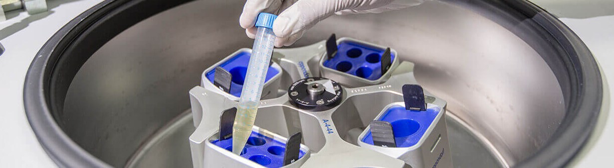 Syngene Lowers FY25 Revenue Guidance, Yet Yes Securities Retains 'Buy' After Q3 Results - Here's Why