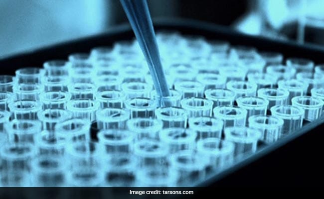 Tarsons Products Shares Make Strong Debut, Lists At Nearly 6% Premium Over Issue Price