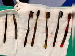 Shocking! पोटदुखीने त्रस्त तरुण डॉक्टरकडे गेला, पोटात दिसलं असं साहित्य, तब्बल 9 ब्रश अन्...