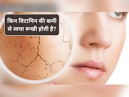 सर्दी में किन विटामिन की कमी से त्वचा रूखी होती है? न्यूट्रिशनिस्ट ने बताया इन चीजों को खाने से स्किन होगी नेचुरली ठीक