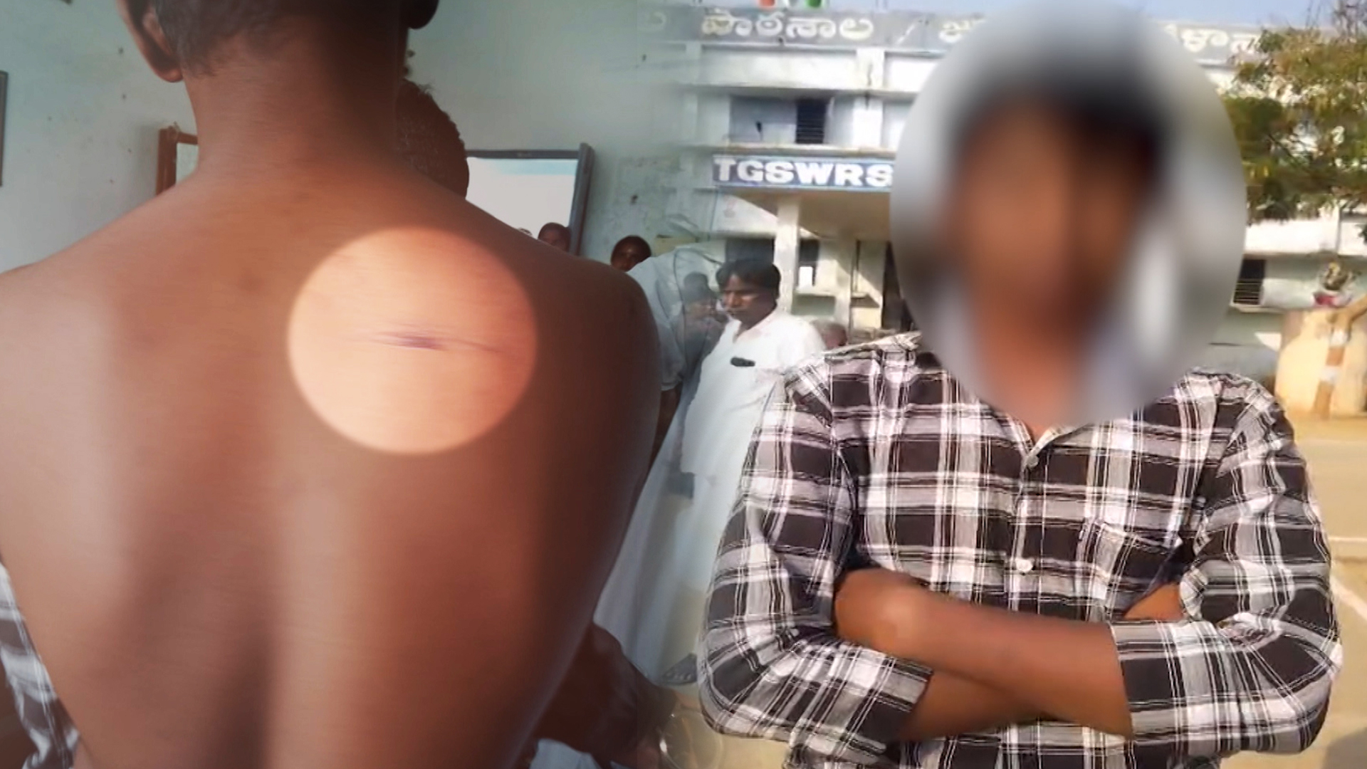 Telangana Ragging Horror: Class 10 Student Beaten With Bats, Sticks Inside Hostel
