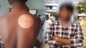 Telangana Ragging Horror: Class 10 Student Beaten With Bats, Sticks Inside Hostel