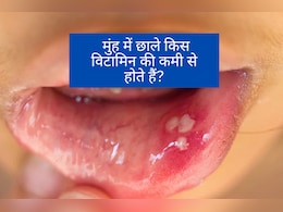 किस Vitamin की कमी से मुंह में निकलते हैं बार-बार छाले? | Muh me chale kyun nikalte hain