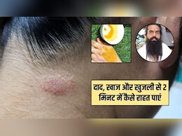 दाद, खाज और खुजली से कैसे छुटकारा पाएं? योग गुरु कैलाश ने बताया हल्दी के साथ लगा लें ये चीज, 2 मिनट में मिल जाएगा आराम