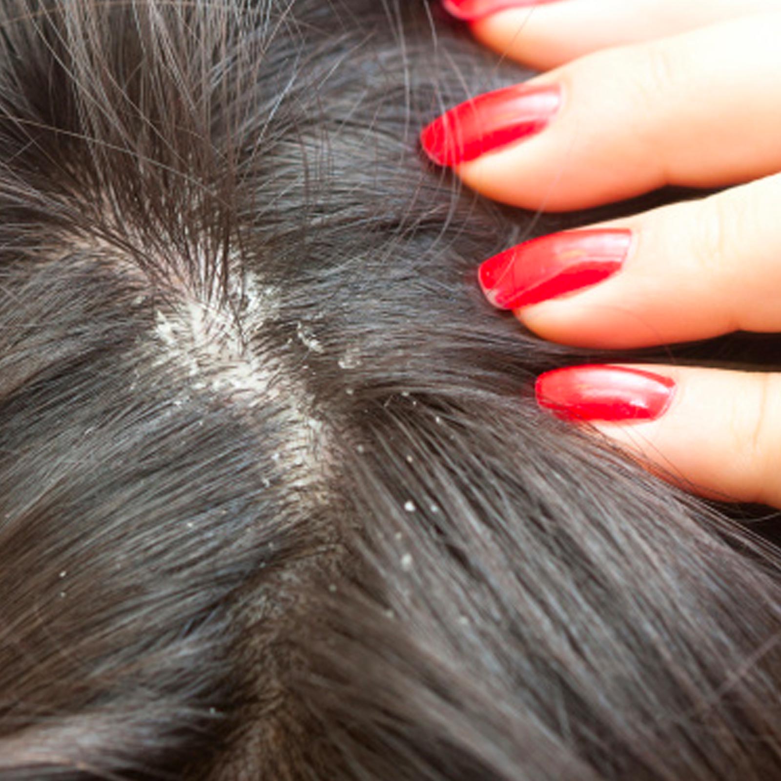 Natural home remedies for winter hair fall.