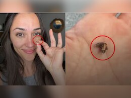 35 सालों से महिला की नाक में फंसी थी ये चीज, जब डॉक्टर ने निकाला तो हर कोई दंग रह गया