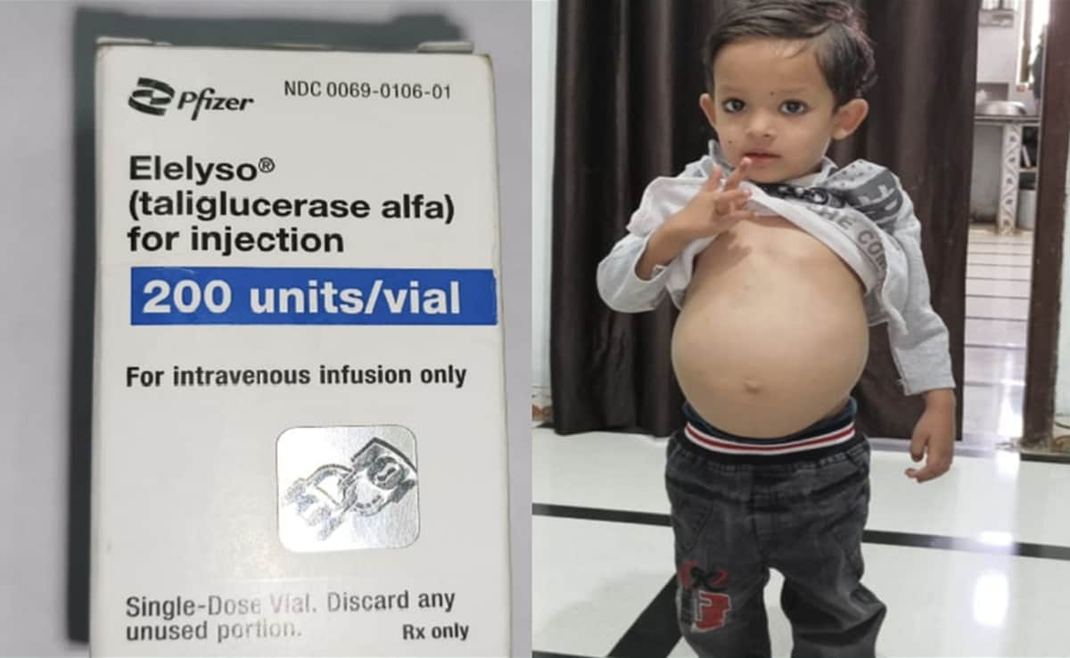 Rare Disease: दुर्लभ बीमारी से पीड़ित मासूम