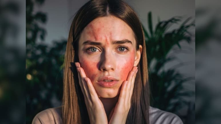 सर्दियों में चेहरे का निखार रहेगा बरकरार, बस आजमाएं ये जादुई Oil, मुहांसे और रूखेपन की होगी छुट्टी