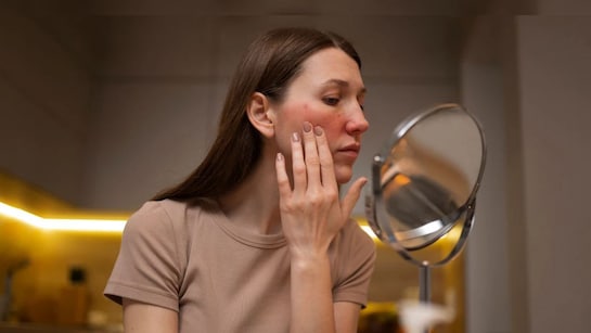 ड्राईनेस दूर करने के लिए डर्मेटोलॉजिस्ट ने बताए आसान उपाय ड्राईनेस दूर करने के लिए डर्मेटोलॉजिस्ट ने बताए आसान उपाय