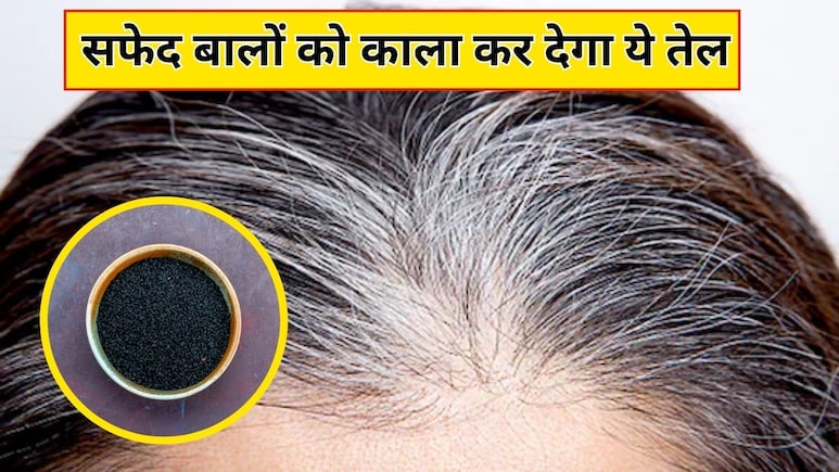 कलौंजी से बाल काले कैसे करें? आयुर्वेदिक न्यूट्रिशनिस्ट ने बताया बस तेल में मिलाकर लगा लें ये 2 चीजें, सिर पर नहीं दिखेगा एक भी सफेद बाल