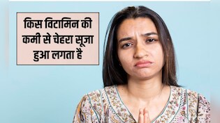 कौन सा विटामिन खाने से गाल फूलता है? किस कमी की वजह से चेहरा सूज जाता है, जान‍िए यहां