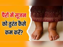 पैरों में सूजन को तुरंत कैसे कम करें? आयुर्वेदिक न्यूट्रिशनिस्ट ने बताया ये 3 काम करने से दूर हो जाएगा दर्द और थकान