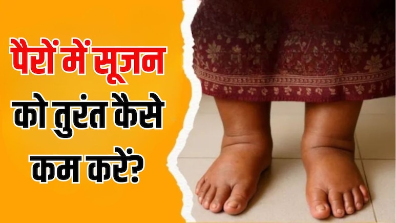 पैरों में सूजन को तुरंत कैसे कम करें? आयुर्वेदिक न्यूट्रिशनिस्ट ने बताया ये 3 काम करने से दूर हो जाएगा दर्द और थकान