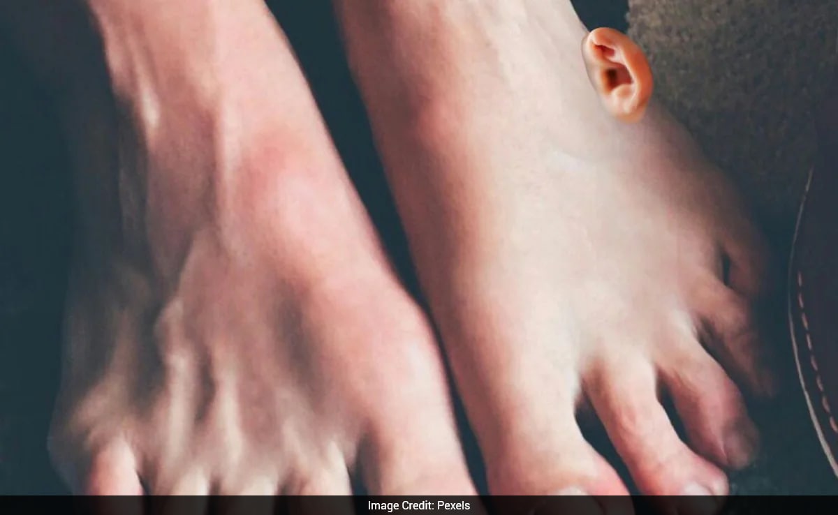 Chinese Surgeons Graft Torn-Off Ear On Patient's Leg Before Reattaching It