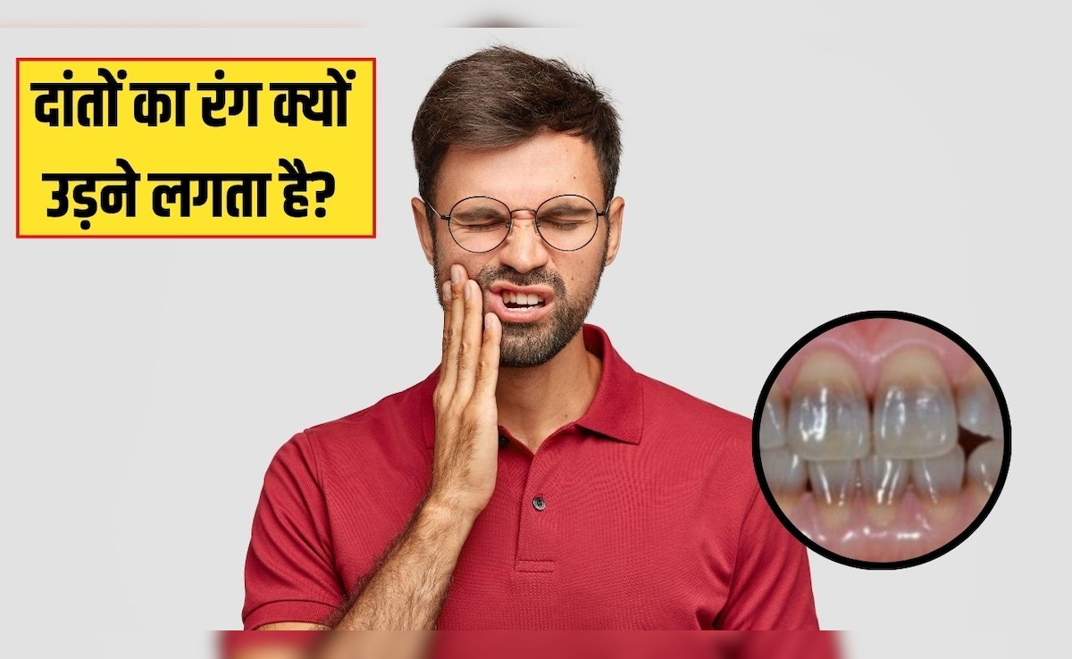 किस विटामिन की कमी से दांत में ठंडा-गर्म लगता है? एक्सपर्ट से जानें क्यों उड़ने लगता है दांतों का रंग