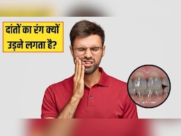 किस विटामिन की कमी से दांत में ठंडा-गर्म लगता है? एक्सपर्ट से जानें क्यों उड़ने लगता है दांतों का रंग