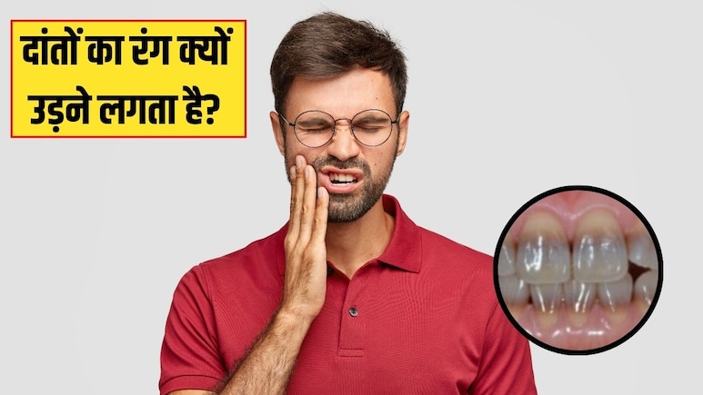 किस विटामिन की कमी से दांत में ठंडा-गर्म लगता है? एक्सपर्ट से जानें क्यों उड़ने लगता है दांतों का रंग