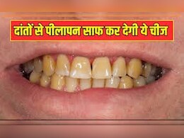 40 की उम्र के  बाद 90% लोगों को होती है डेंटल प्रॉबलम्स, इन घरेलू नुस्खे से दांतों को बनाएं मजबूत और मोतियों सा सफेद | DIY Toothpaste
