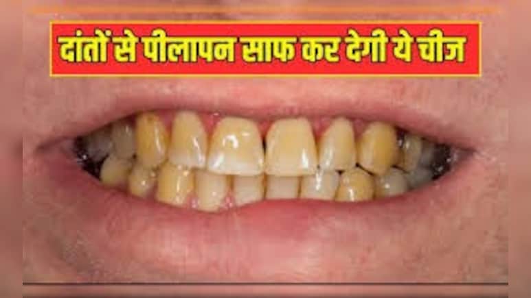 40 की उम्र के  बाद 90% लोगों को होती है डेंटल प्रॉबलम्स, इन घरेलू नुस्खे से दांतों को बनाएं मजबूत और मोतियों सा सफेद | DIY Toothpaste