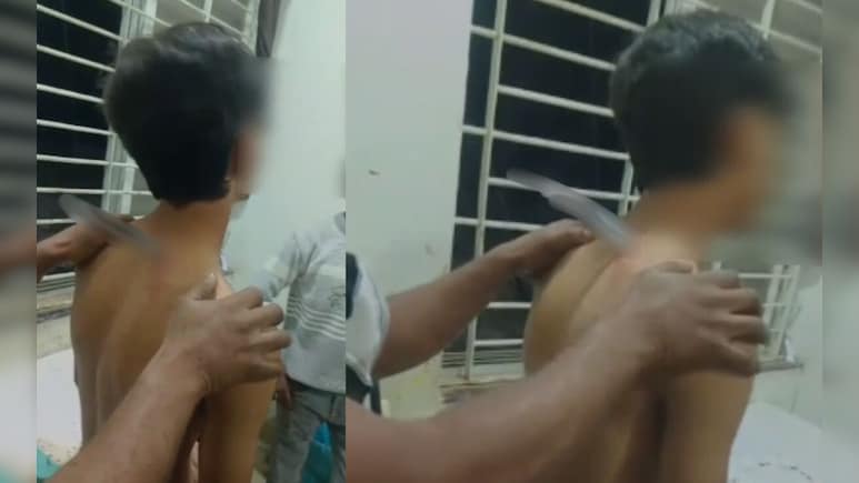 बाइक बाइक टकराने पर पीठ में घोंपा चाकू, उसी हालत में अस्पताल पहुंचा घायल युवक, डॉक्टर भी रह गए दंग