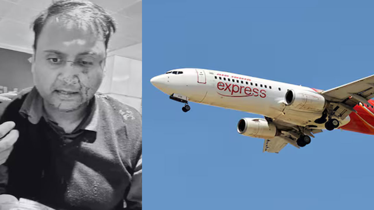 Passenger Says Air India Express Pilot Thrashed Him, Left Him Bloodied. Airline Responds