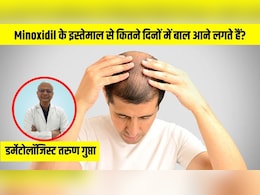 Minoxidil के इस्तेमाल से कितने दिनों में बाल आने लगते हैं? डर्मेटोलॉजिस्ट से जानें मिनोक्सिडिल कैसे लगाएं