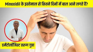 Minoxidil के इस्तेमाल से कितने दिनों में बाल आने लगते हैं? डर्मेटोलॉजिस्ट से जानें मिनोक्सिडिल कैसे लगाएं