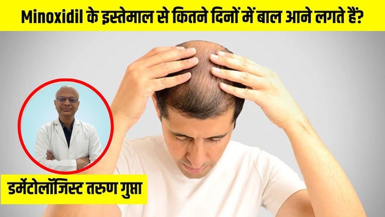 Minoxidil के इस्तेमाल से कितने दिनों में बाल आने लगते हैं? डर्मेटोलॉजिस्ट से जानें मिनोक्सिडिल कैसे लगाएं