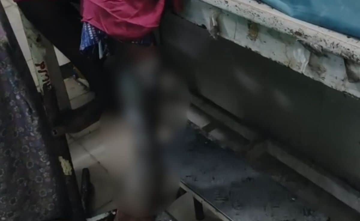 Telangana Nursing Student Attacked With Chemical Substance, Suffers Injuries