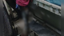 Telangana Nursing Student Attacked With Chemical Substance, Suffers Injuries