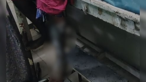 वारंगल में नर्सिंग स्टूडेंट पर केमिकल अटैक, अस्पताल में भर्ती लड़की, बाइक सवार आरोपियों की तलाश में पुलिस