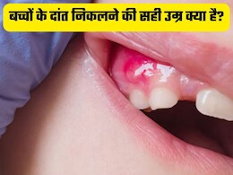 बच्चों के दांत निकलने की सही उम्र क्या है? जानें कब निकलते हैं बच्चों के दांत, लक्षण और दर्द से राहत पाने के उपाय