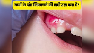 बच्चों के दांत निकलने की सही उम्र क्या है? जानें कब निकलते हैं बच्चों के दांत, लक्षण और दर्द से राहत पाने के उपाय
