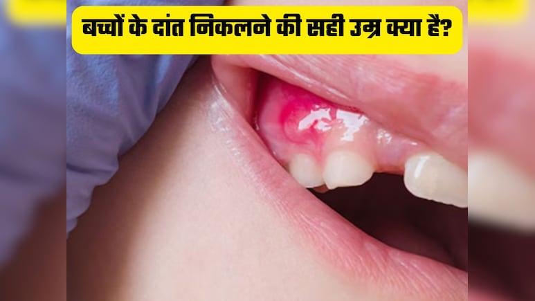 बच्चों के दांत निकलने की सही उम्र क्या है? जानें कब निकलते हैं बच्चों के दांत, लक्षण और दर्द से राहत पाने के उपाय