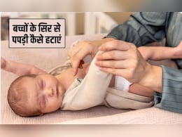 बच्चों के सिर से पपड़ी कैसे हटाएं? मेरे बच्चे की खोपड़ी क्यों छील रही है, हर सवाल का जवाब डॉक्&zwj;टर से जान&zwj;िए