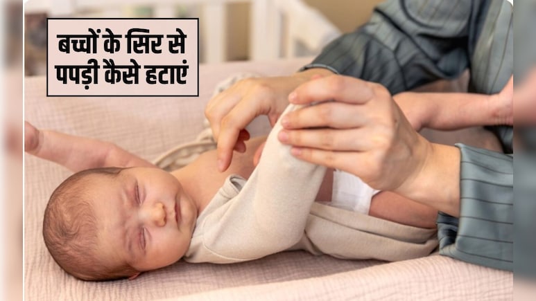 बच्चों के सिर से पपड़ी कैसे हटाएं? मेरे बच्चे की खोपड़ी क्यों छील रही है, हर सवाल का जवाब डॉक्&zwj;टर से जान&zwj;िए