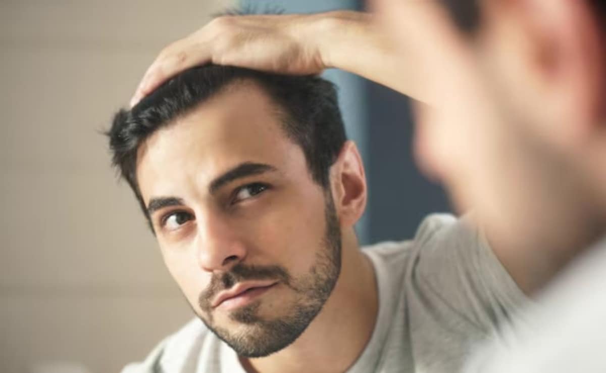 Male Pattern Baldness Cure Found... In An Acne Drug Approved 5 Years Ago