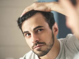 Scientists Find Cure For Male Pattern Baldness In Acne Drug Approved 5 Years Ago