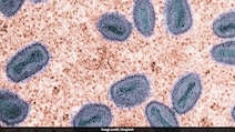 2 Cases Of New Mpox Virus Strain Confirmed In India And UK