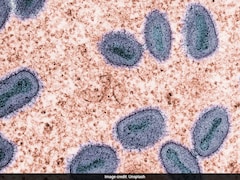 2 Cases Of New Mpox Virus Strain Confirmed In India And UK