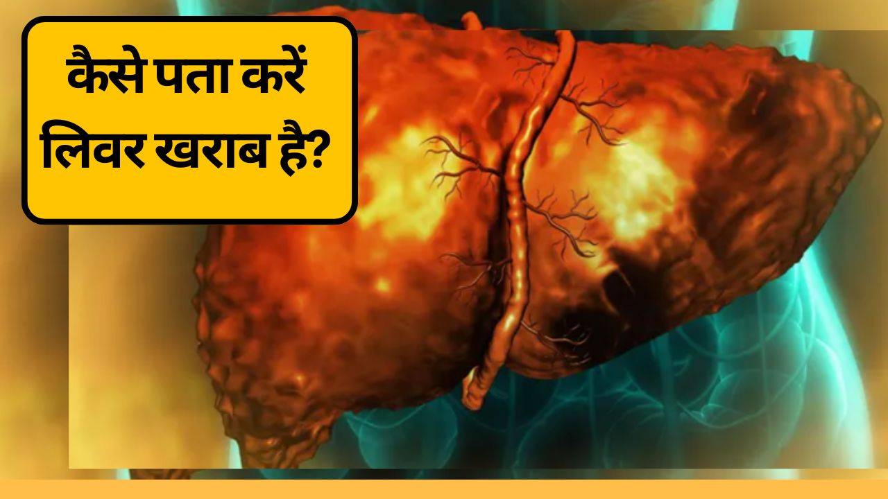 कैसे पता करें लिवर खराब है? | लिवर डैमेज के 5 बड़े संकेत, जिन्हें नजरअंदाज न करें!