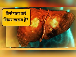 कैसे पता करें लिवर खराब है? | लिवर डैमेज के 5 बड़े संकेत, जिन्हें नजरअंदाज न करें!
